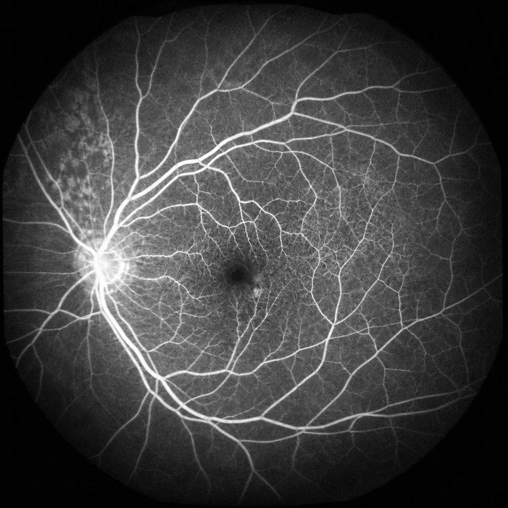 A fluorescein angiogram at about twelve seconds. It is the one substance I ever watched arrive, and it was engineered specifically so that it would.