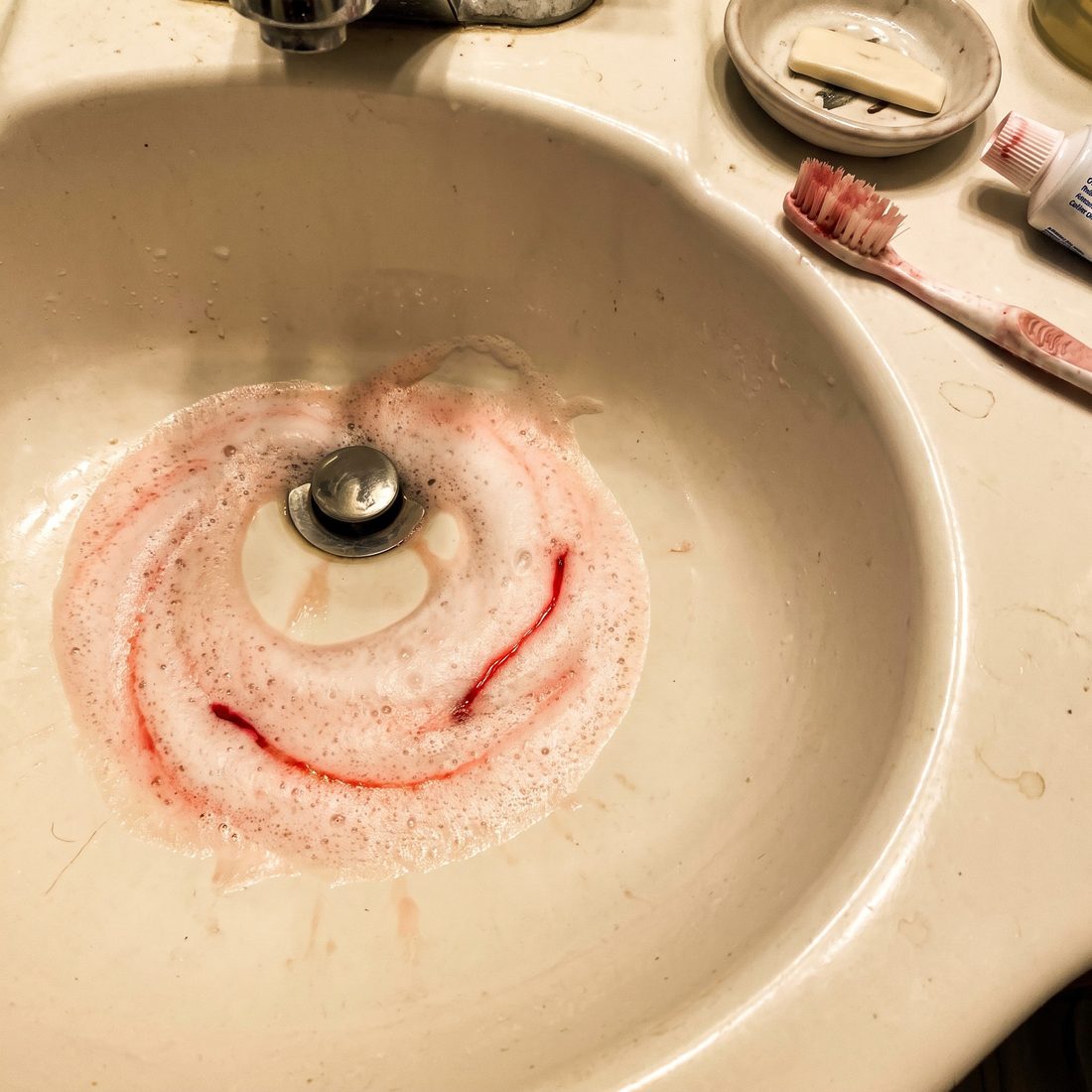 Pink, blood-streaked toothpaste foam in the sink on Day 1